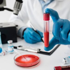 Lipid Profile